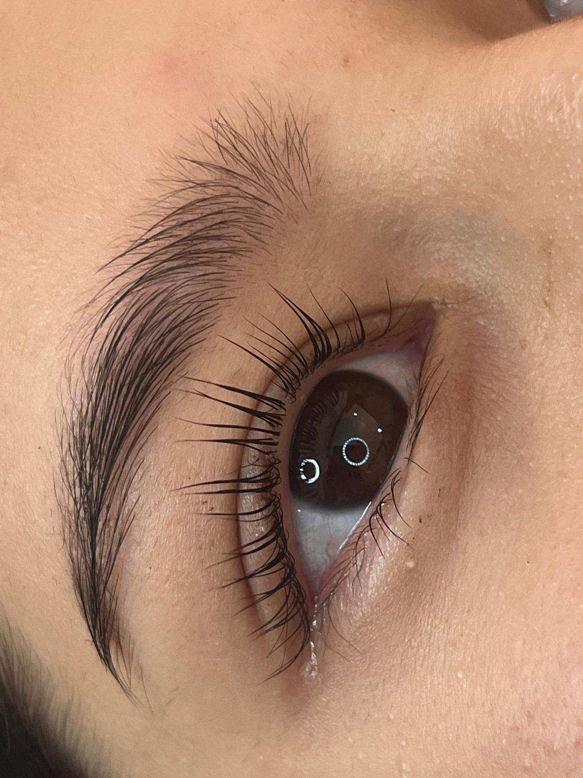 Servicio Premium Harmony Esthetics